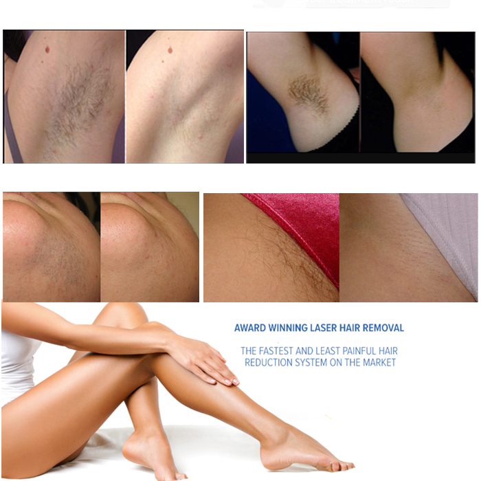 HTB1XfQThmfD8KJjSszhq6zIJFXae (1)